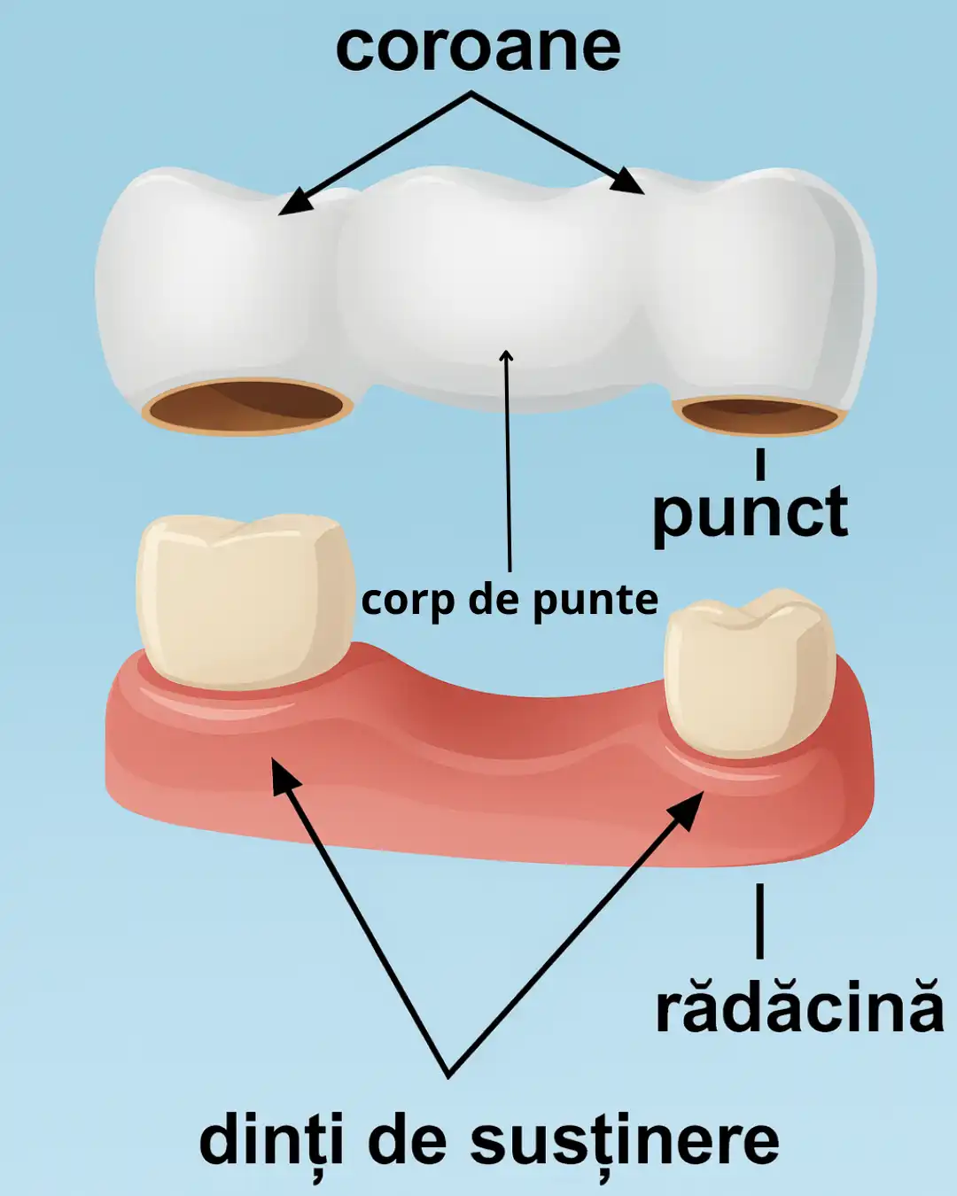 punti dentare cabinet stomatologic focsani-exemplificare