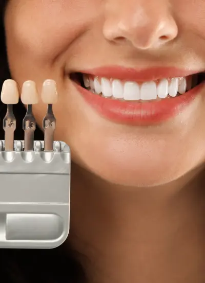 Protetică Dentară în Focșani coronite