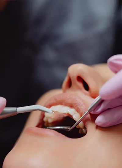 Protetică Dentară în Focșani portelan